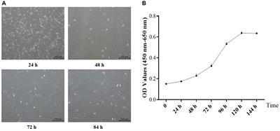 Establishment of an immortalized yak granulosa cell line: in vitro tool for understanding the molecular processes of ovarian follicle development